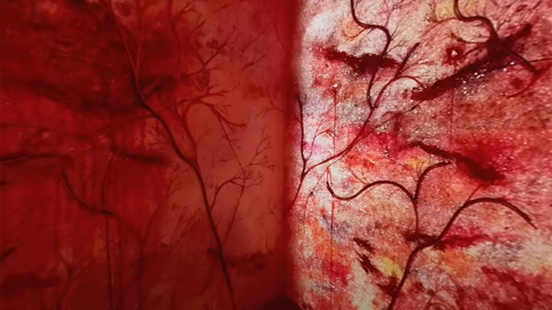 Inside the Invisible Pain - A poem and VR video by Arti Shah